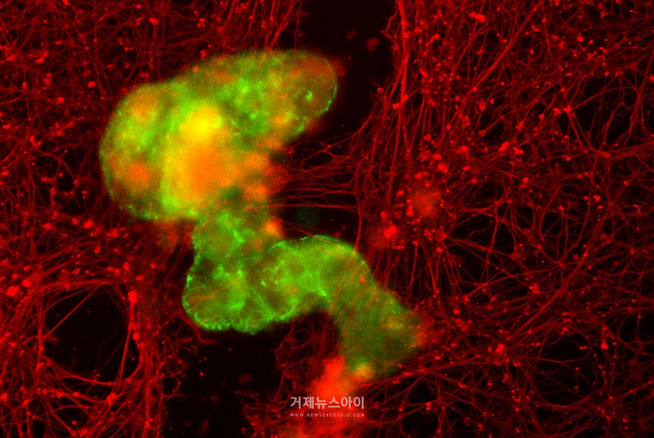 신경 조직(빨간색)을 가로질러 이동하고 있는 앤스로봇(초록색). ⓒGizem Gumuskaya et al., 2023 Advanced Science
